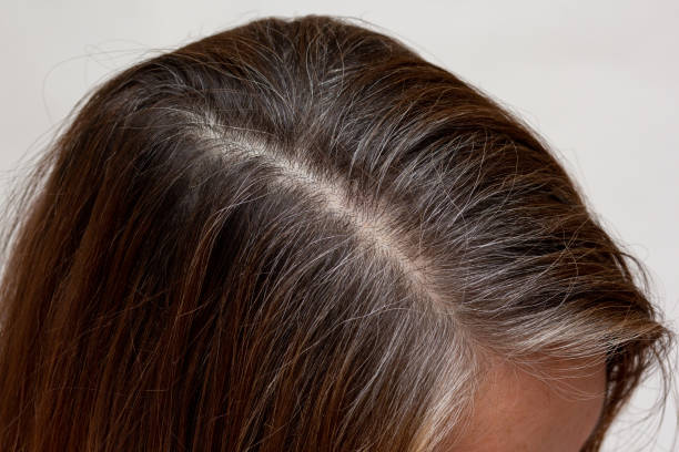 istock Top view of regrowth root with grey hair 2061908729