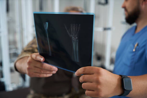 A doctor or radiologist is carefully reviewing a hand x-ray. Image shows two views of a patient's hand, clear view of the bones and joints