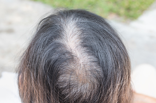 Senior aged asian woman concern about gray hair in menopause.
