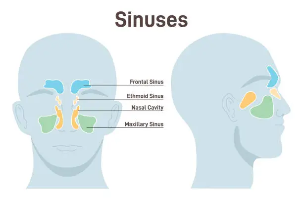 Vector illustration of Nasal sinuses. Healthy nasal cavity paired air-filled spaces. Frontal, ethmoid,