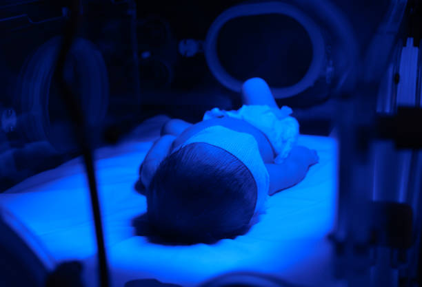 istock Newborn Baby Receiving Blue Light Treatment 2065214307