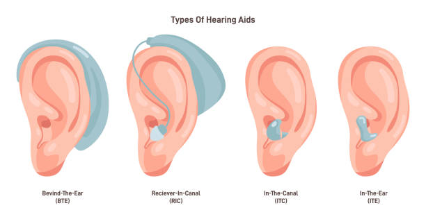 Hearing aids types set. Neuroprosthesis to a deaf person. Hearing loss vector art illustration