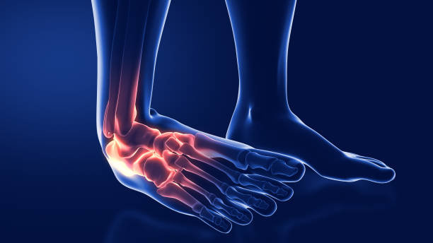 istock sprains and dislocations to the ankle 2065566311