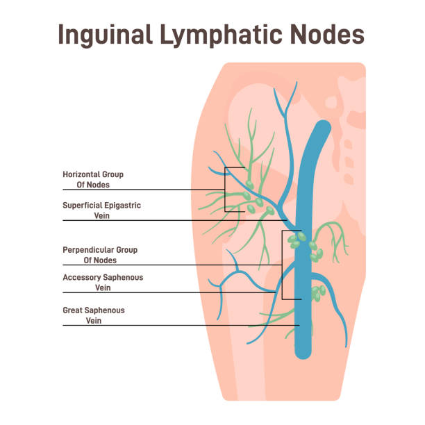 illustrations, cliparts, dessins animés et icônes de ganglion lymphatique inguinal. échange de liquides, défense de l’organisme contre les infections - immune defence illustrations