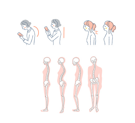 woman, posture, comparison, hunched back, symptoms, worries, neck, bone, distortion