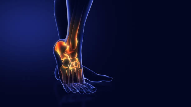 istock Medical animation for ankle pain 2067321161