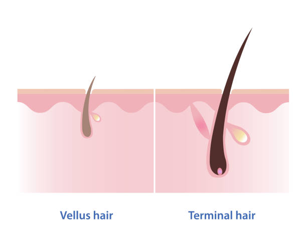 202403-Vellus and terminal hair The difference between vellus hair and terminal hair vector illustration isolated on white background. Hair Types. Vellus hair is fine, wispy and unpigmented hair. Terminal hair is thick, coarse, long and pigmented hair. arrector pili stock illustrations
