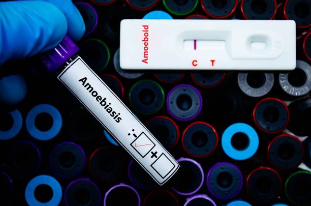 rdt - oncocercíase - fotografias e filmes do acervo
