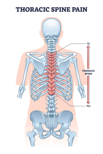 Thoracic spine pain as soft tissue muscle inflammation outline diagram. Labeled educational medical backbone skeletal trauma as painful problem vector illustration. Chronic vertebrae posture condition