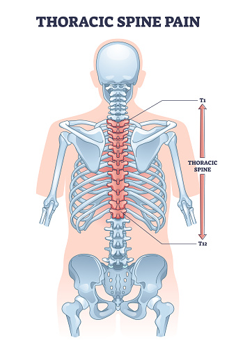 Thoracic Spine Pain As Soft Tissue Muscle Inflammation Outline Diagram thoracic-spine-pain-as-soft-tissue-muscle-inflammation-outline-diagram