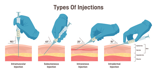 Types of injections. Guide to injecting medication into skin. Doctor holding syringes at different angles. Intramuscular, intradermal, intravenous and subcutaneous injection. Flat vector illustration
