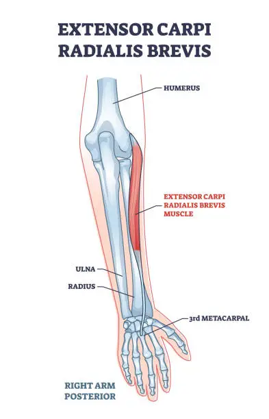 Vector illustration of Extensor carpi radialis brevis muscle with arm and hand bones outline diagram