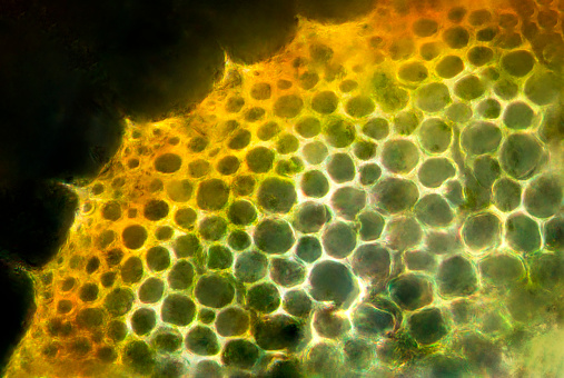 Micrograph, with polarization, of a cross section of the stem of a peat moss, Sphagnum recurvum, showing the thick-walled water conducting cells in the center (hydroids).