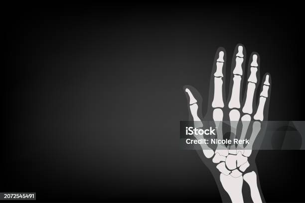 X Ray Rabbit Hand Xray Hand Of Human Stock Illustration - Download Image Now - Adult ...