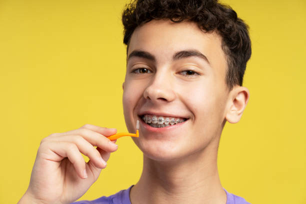 istock Handsome, smiling boy with braces using interdental brush, looking at camera. Attractive teenager 2074493383