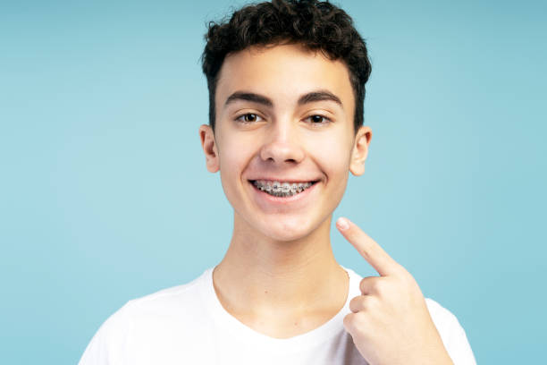 istock Positive attractive boy with braces pointing finger to mouth, looking at camera 2074493395