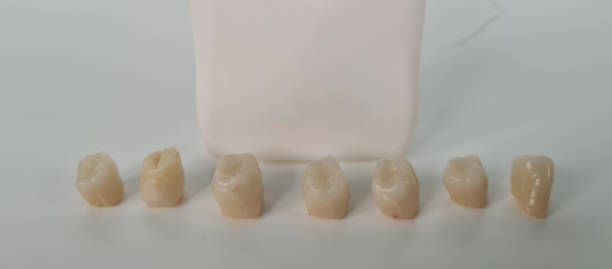 istock Dental care and tooth with caries. Teeth model with dental floss 2074786721