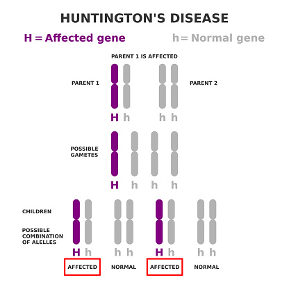 One parent is affected. Children have fifty fifty possibility of inheriting disease. Chromosome 4 HTT is mutated. Vector illustration.