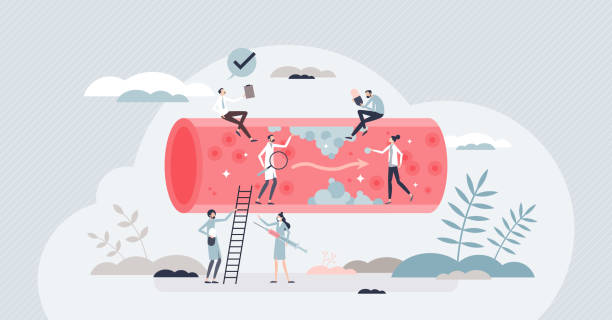 High cholesterol checkup to detect disease or blood risks tiny person concept High cholesterol checkup to detect disease or blood risks tiny person concept. Heart attack awareness from too high pressure and unhealthy artery vector illustration. Cardiologist patient health care cholesterol screening stock illustrations