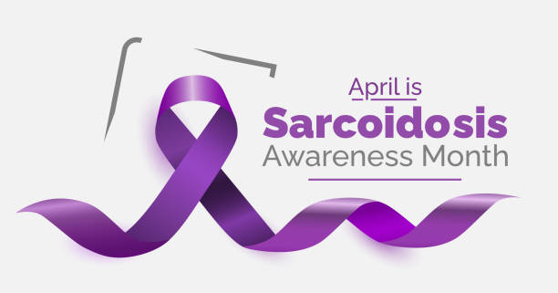 istock Sarcoidosis Awareness Month. Inflammatory disease resulting in granulomas in body. Observed in April each year. 2078069753