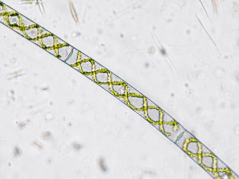 Spirogyra algae (filamentous green algae) under the microscope - optical microscope x400 magnification