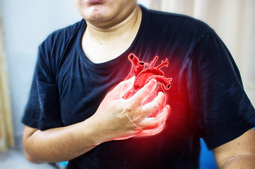Heart attack. Man clutching his chest from acute pain. Heart attack symptom.