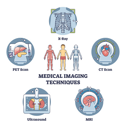 Medical imaging techniques for medical body diagnostics outline diagram. Labeled educational scheme with types for bones or organs inner examination vector illustration. X-ray, CT scan or MRI record.