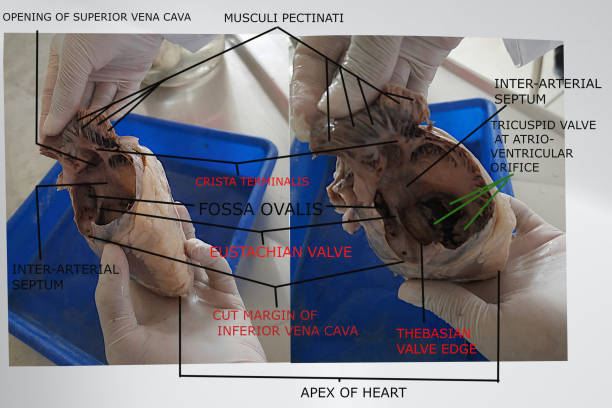 the image showing fossa ovalis, crista terminalis, musculi pectinati, heart valves and inter-arterial septum