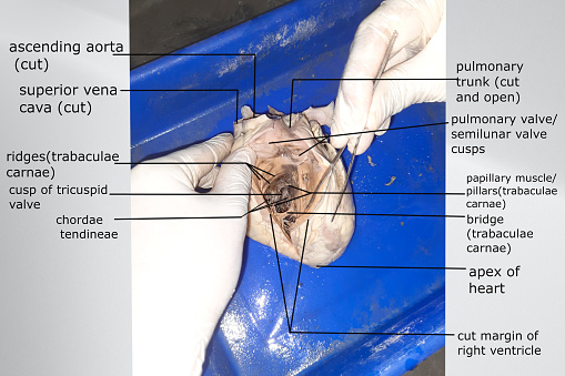 right ventricle interior view showing mitral valve, chordae tendinae, papillary muscles and other related structure