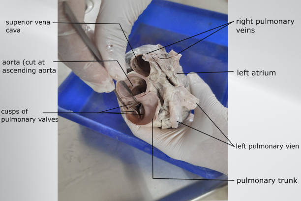 superior view of heart showing opening of aorta, superior vena cava, pulmonary trunk with related valve