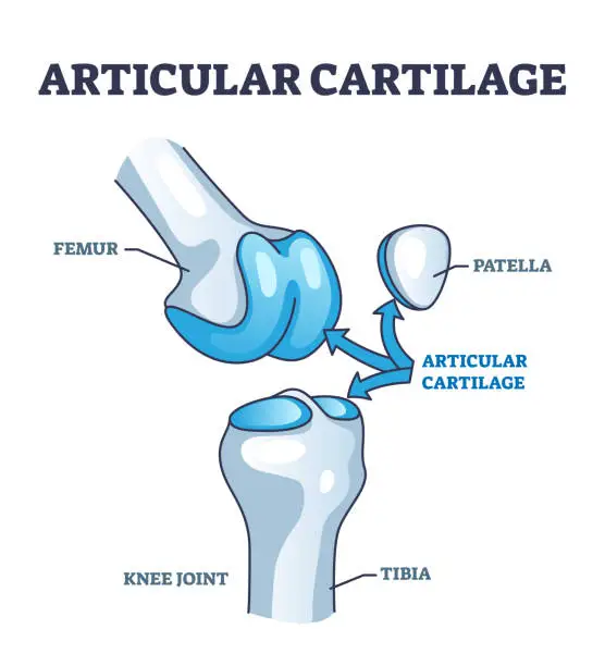 Vector illustration of Articular cartilage structure and location in knee joint outline diagram