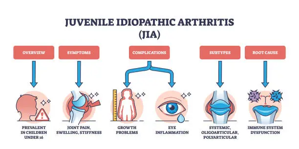 Vector illustration of Juvenile idiopathic arthritis or JIA ad children disease outline diagram