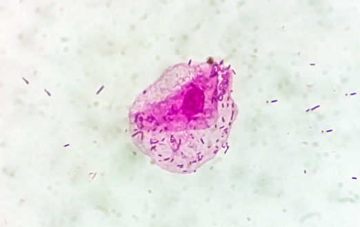Microscopic close view of high vaginal swab Gram stain smear, 100x. diagnosis of Bacterial vaginosis (BV).