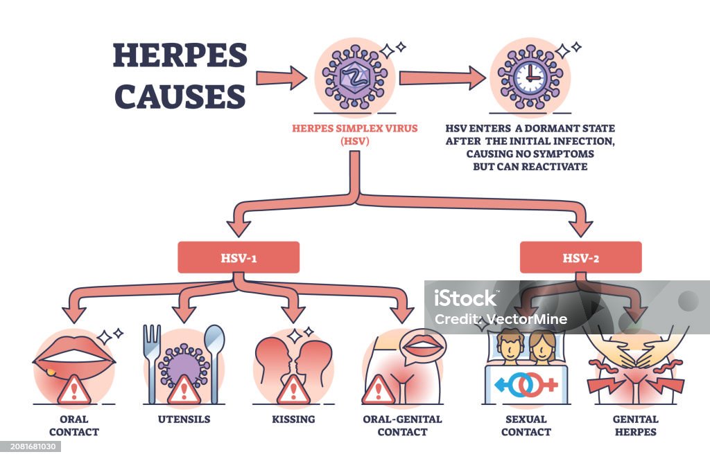What Kind Of Herpes Does Nba Have Herpes Causes And Medical Skin Hsv Virus Transmission Outline Diagram