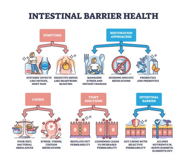 Vector illustration of Intestinal barrier health and leaky gut syndrome explanation outline diagram