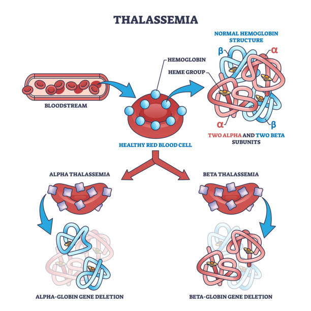 헤모글로빈 구조 결실로서의 지중해빈혈 혈액 질환 개요도 - blood cell anemia cell structure red blood cell stock illustrations