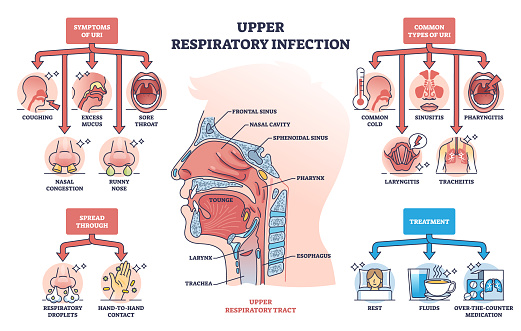 Upper respiratory infection with symptoms and types outline diagram. Labeled educational health condition scheme with coughing, sore throat and nasal problems vector illustration. Medical description