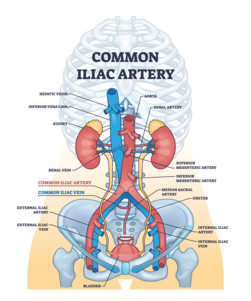 istock Common iliac artery as aorta towards the pelvic region outline diagram 2082359622