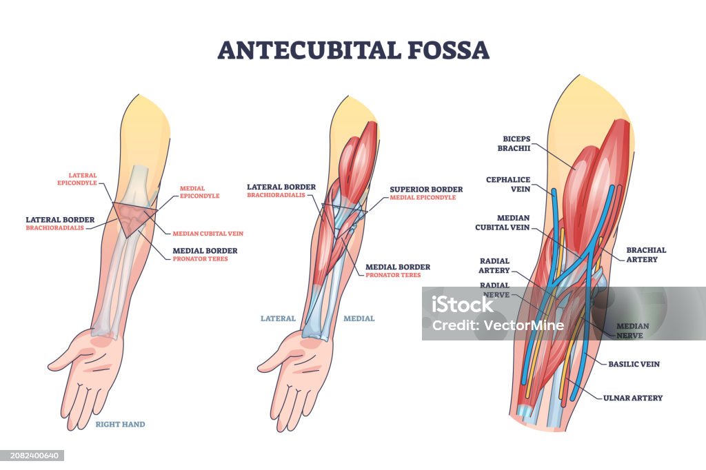 Iv In The Ac Antecubital Fossa Anatomy With Human Hand Structure Outline Diagram ...