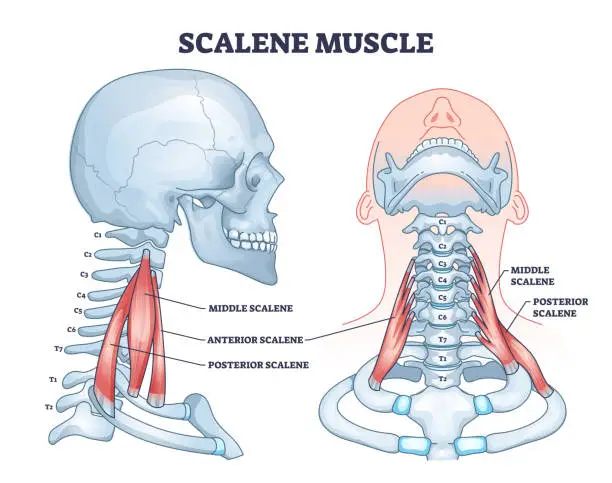 Vector illustration of Scalene muscle structure with anatomical location on neck outline diagram