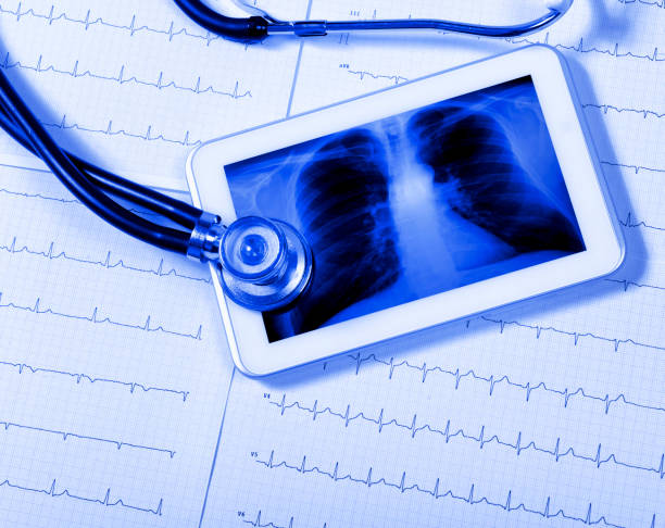 medical exam concept, blue toned. - digital tablet doctor note pad x ray image - fotografias e filmes do acervo