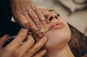 Injections of the lips. Correction form the upper lip. Injection of beauty. Spa. Facial Rejuvenation. Lip augmentation.