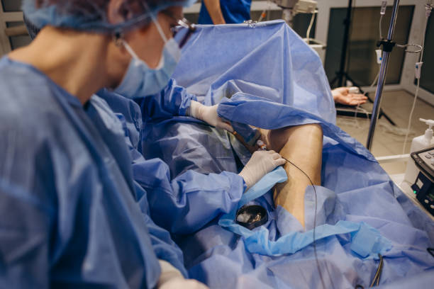 istock Modern treatment of varicose veins with laser system 2084985202