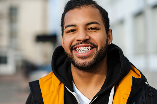 Portrait photo of a smiling, handsome African American student with dental braces, wearing a jacket, posing on an urban street and looking at the camera
