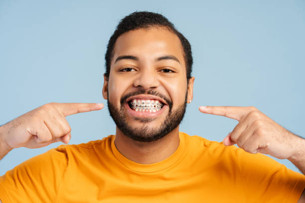 istock Smiling confident man pointing fingers on dental braces, looking at camera, isolated 2085204758