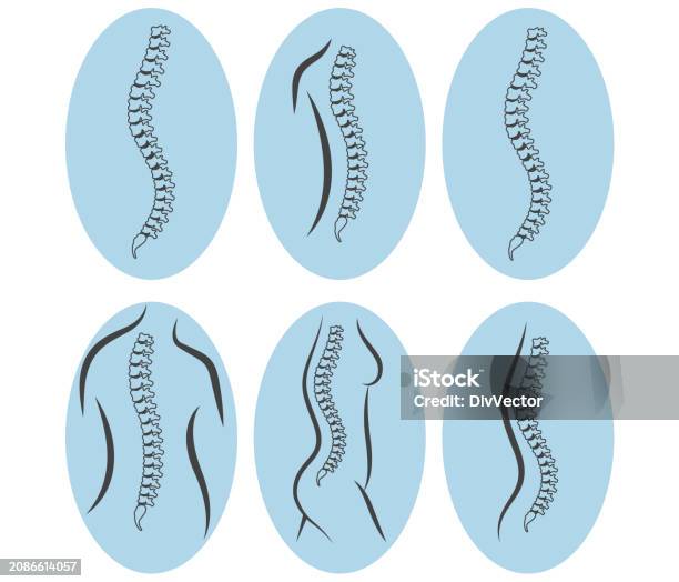 Spine Vector Design Human Spine Vector Illustration Stock Illustration - Download Image Now ...