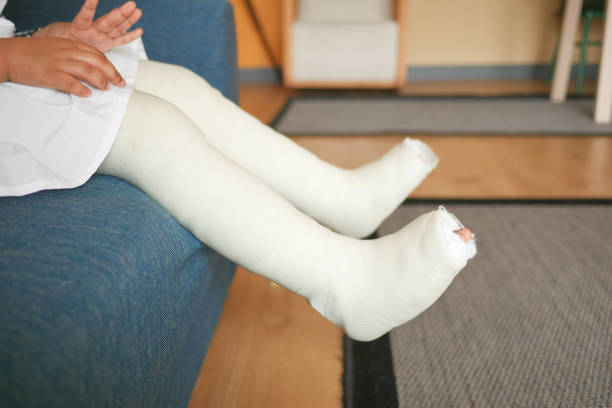 istock little child with plaster bandage on leg. 2086943408