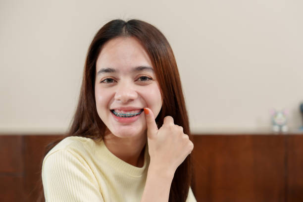 istock Asian female, pointing to braces, slight smile, cream top, clear focus on dental alignment, Eager adult showcases teeth straightening device, subtle grin, wooden furnishing completes homely scene 2091507191