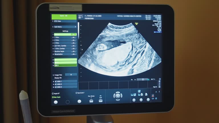 Human embryo is slightly moving his head on an ultrasound display