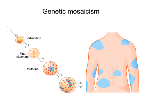 Genetic mosaicism. Somatic mutation. DNA replication errors. Cell development from Fertilization to morula with mutation. Human body with affected areas. Somatic genome editing. Vector illustration
